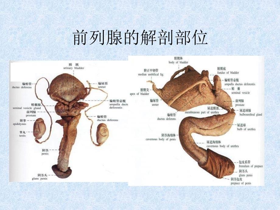 前列腺增生症PPT课件_第3页