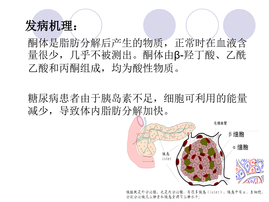 糖尿病酮症酸中毒病人护理查房PPT课件_第4页