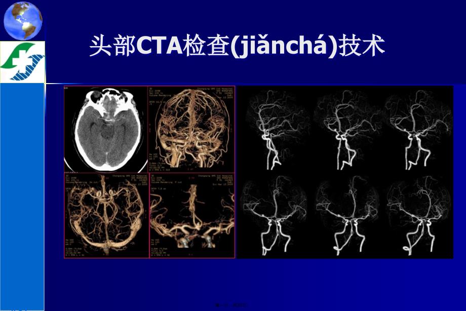 头部CTA检查技术学习资料_第1页