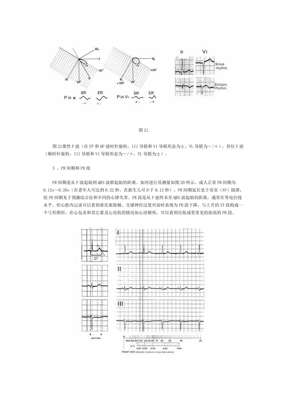 3心电图的解读及正常心电图的特征.doc_第4页