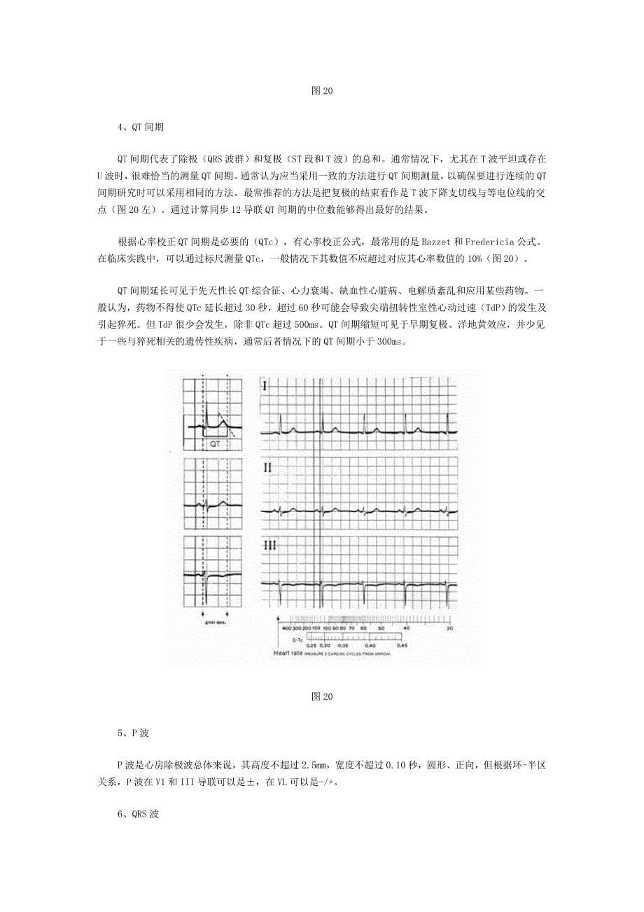 3心电图的解读及正常心电图的特征.doc_第5页