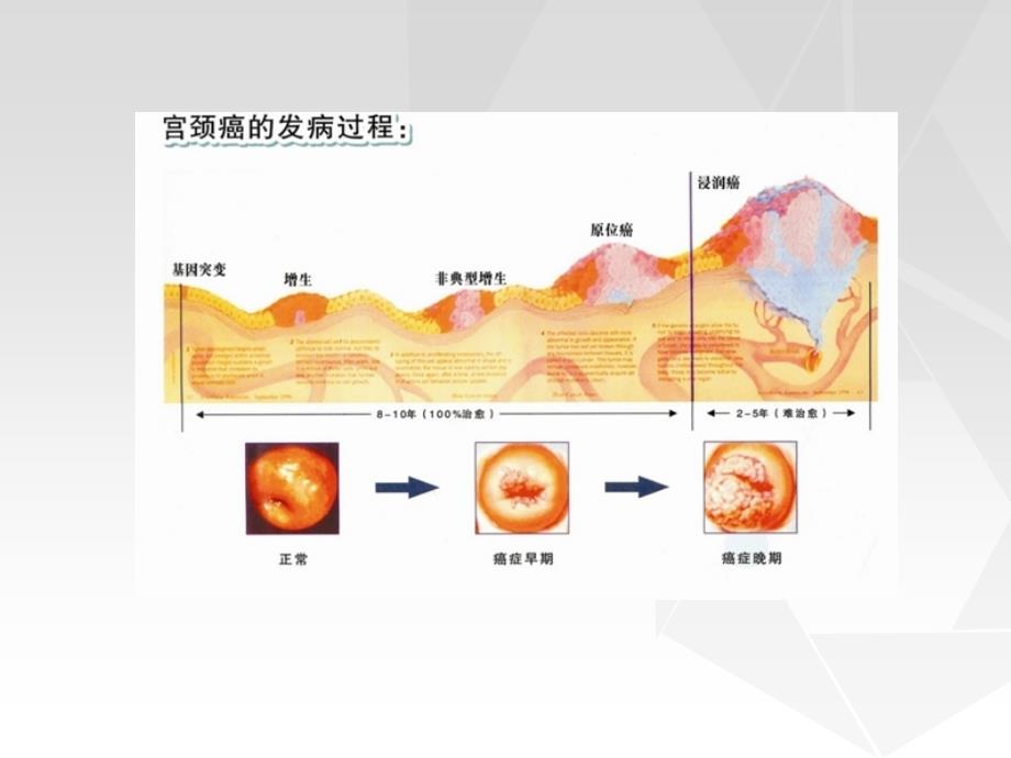 不典型鳞状上皮细胞PPT课件_第3页