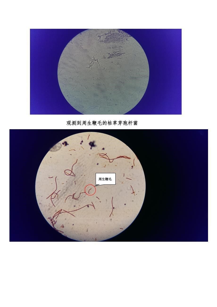 实验四-观察鞭毛菌的运动、细菌鞭毛染色_第5页