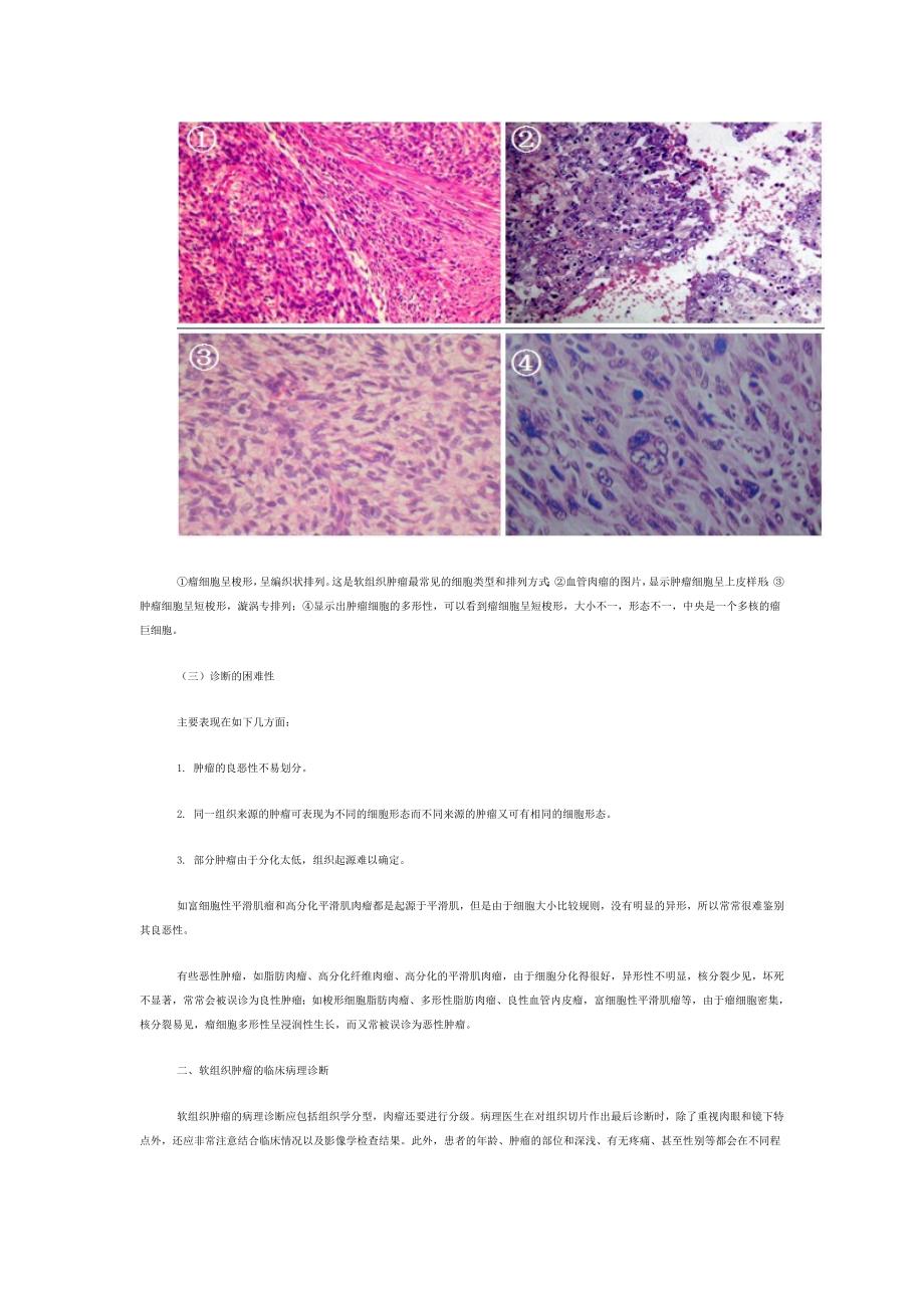 组织化学与免疫组化在软组织肿瘤诊断中的应用.doc_第2页