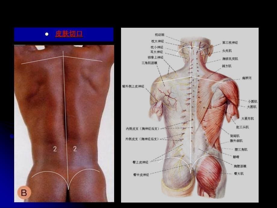 《脊柱区的解剖》PPT课件_第5页