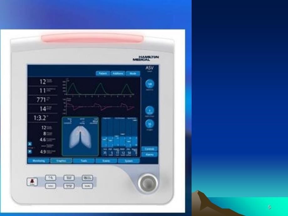 呼吸机应用PPT课件_第5页