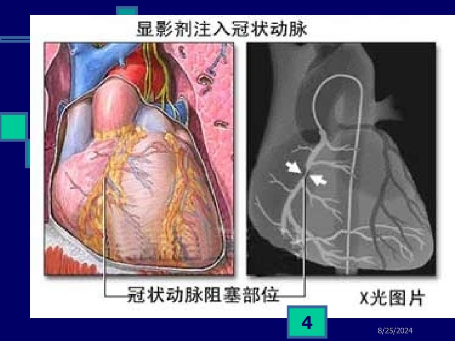 心血管系统药PPT课件_第4页