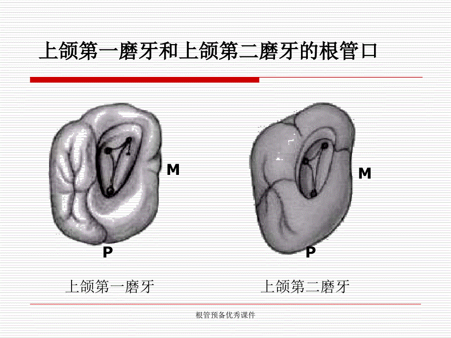 根管预备优秀课件_第4页