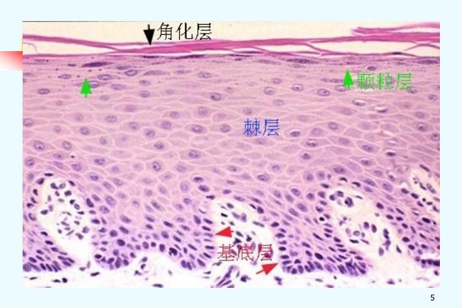 口腔粘膜组织病理.ppt_第5页