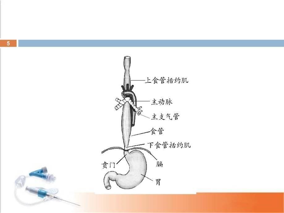 食管术后吻合口瘘的观察及护理_第5页