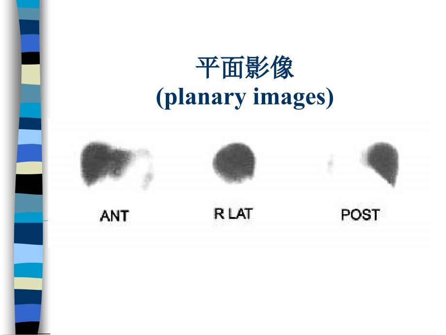 消化系统核医学PPT课件_第4页