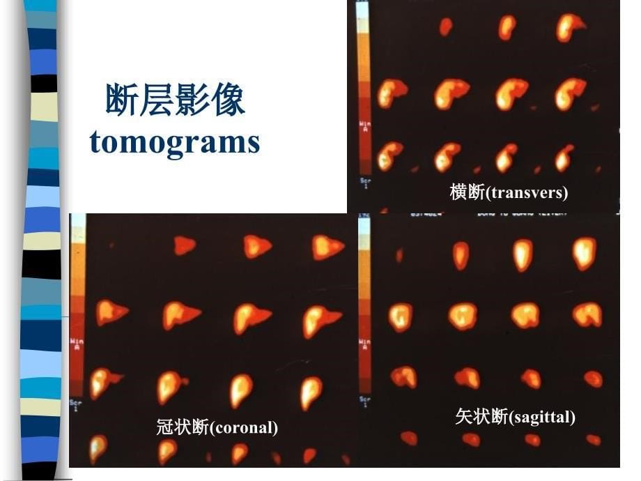 消化系统核医学PPT课件_第5页