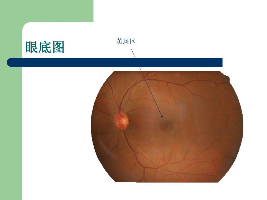 《老年人常见眼病》PPT课件_第4页