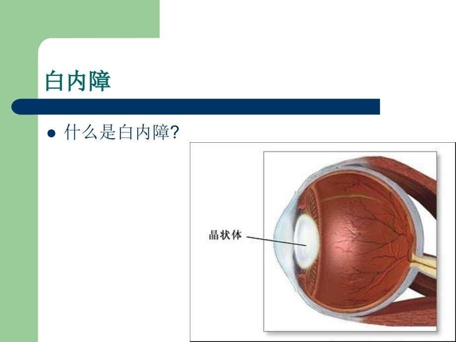 《老年人常见眼病》PPT课件_第5页