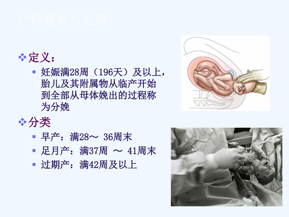 产程观察与处理2_第1页