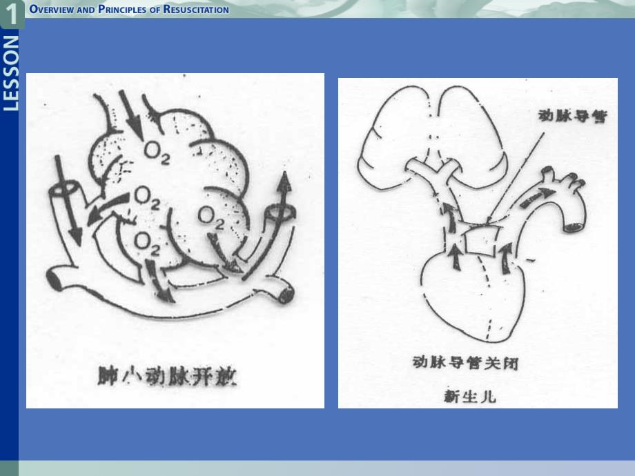 新生儿心肺复苏ppt课件_第4页