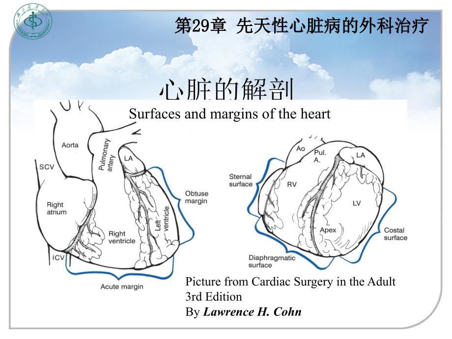 外科学教学课件：先天性心脏病的外科治疗_第4页