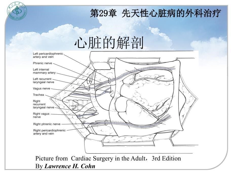 外科学教学课件：先天性心脏病的外科治疗_第5页