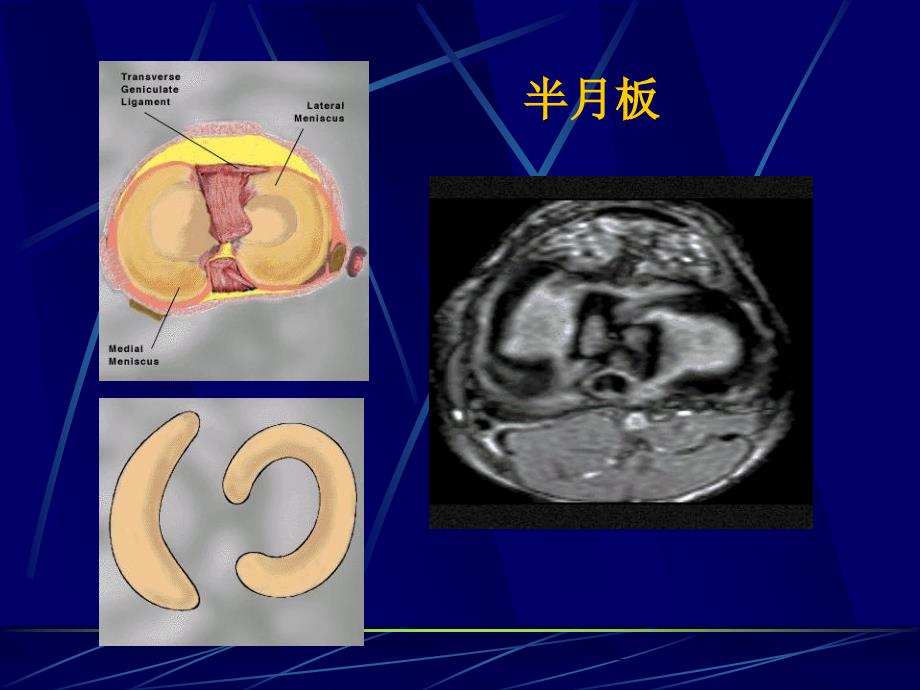 四肢关节解剖.ppt_第4页