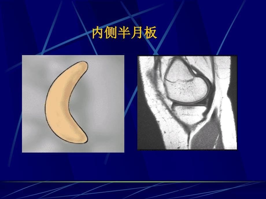 四肢关节解剖.ppt_第5页