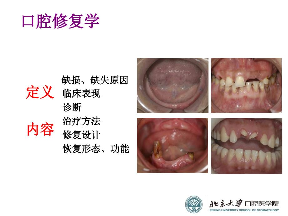 《口腔修复学》PPT课件.ppt_第2页