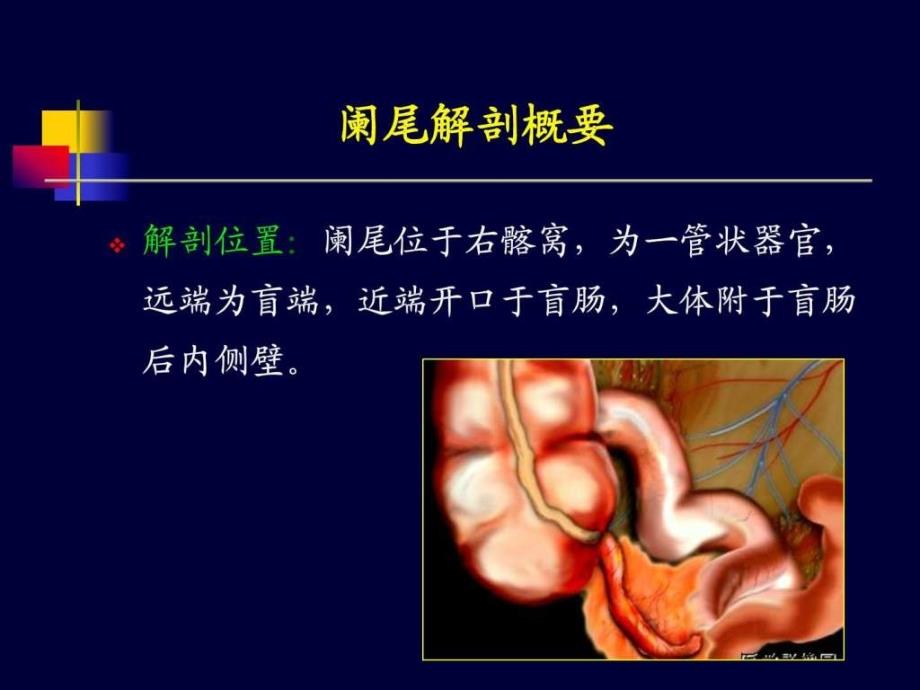 《阑尾炎超声诊断》PPT课件_第3页