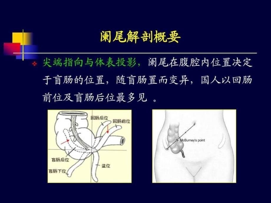 《阑尾炎超声诊断》PPT课件_第5页