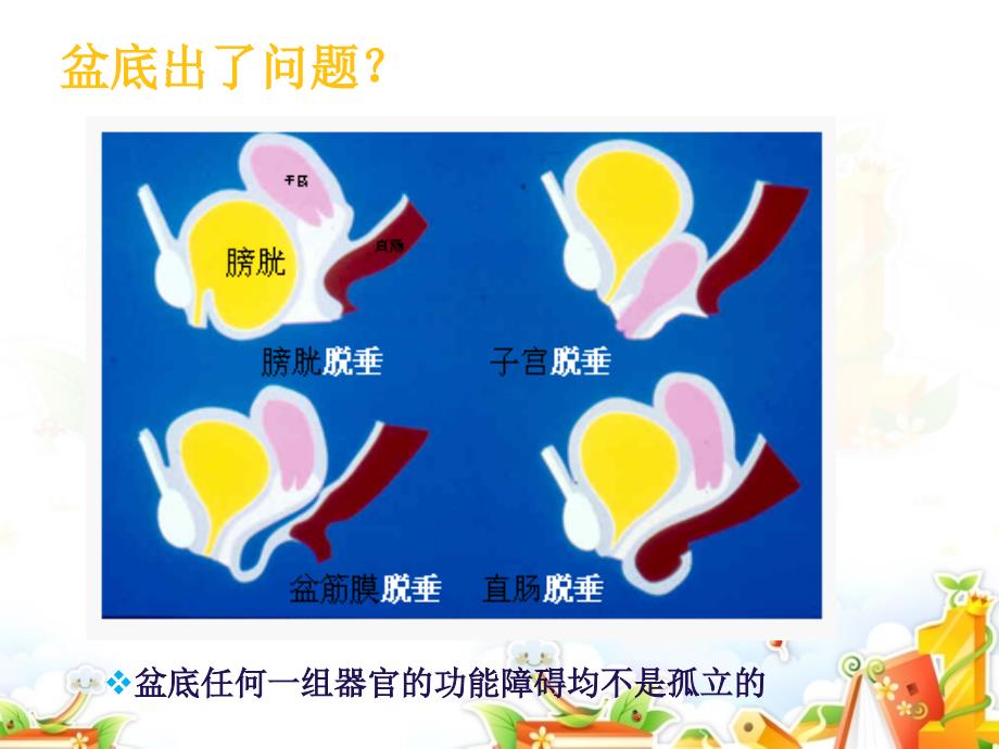 盆底康复治疗.ppt_第4页