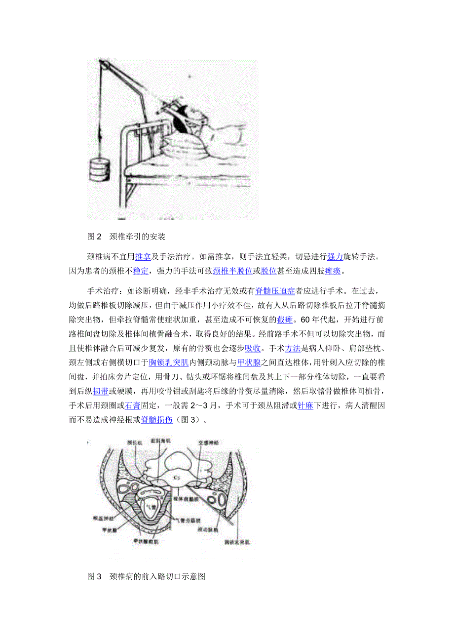 医学百科颈椎病.doc_第3页