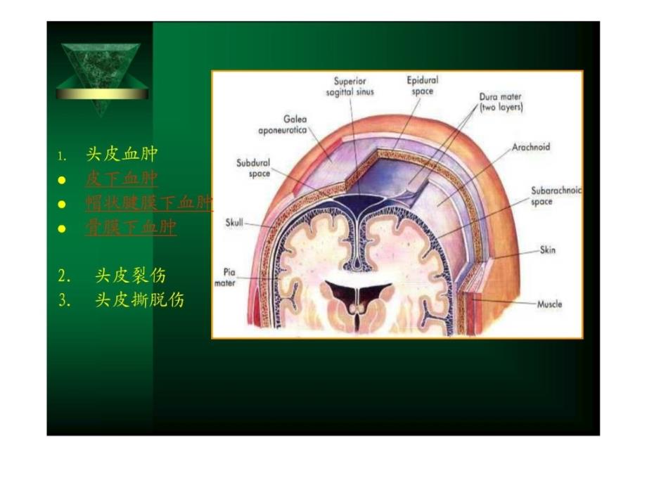 神经外科医学学ppt课件_第4页