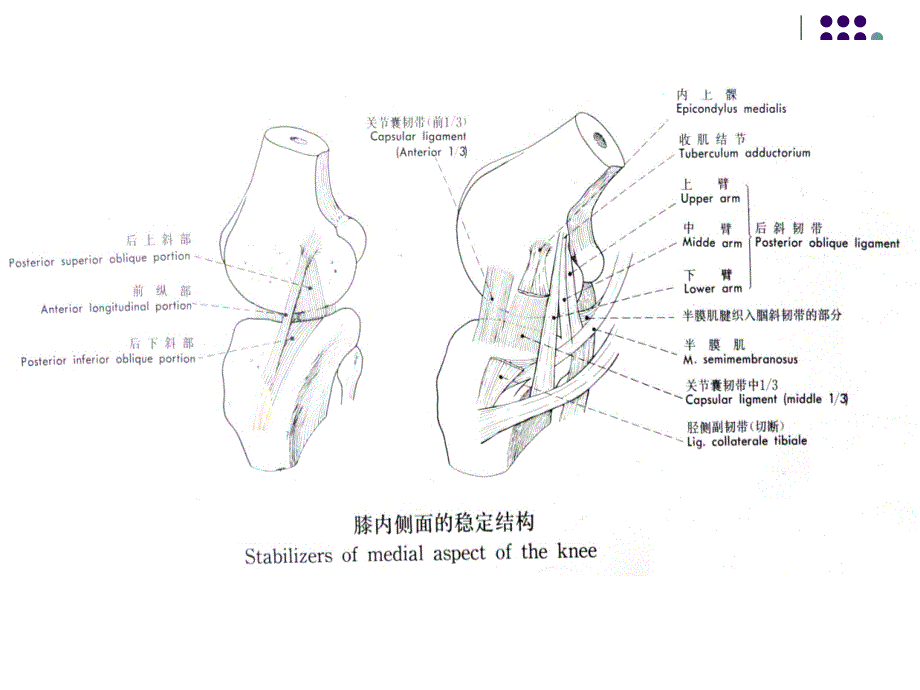 膝关节后内角损伤的外科治疗_第4页