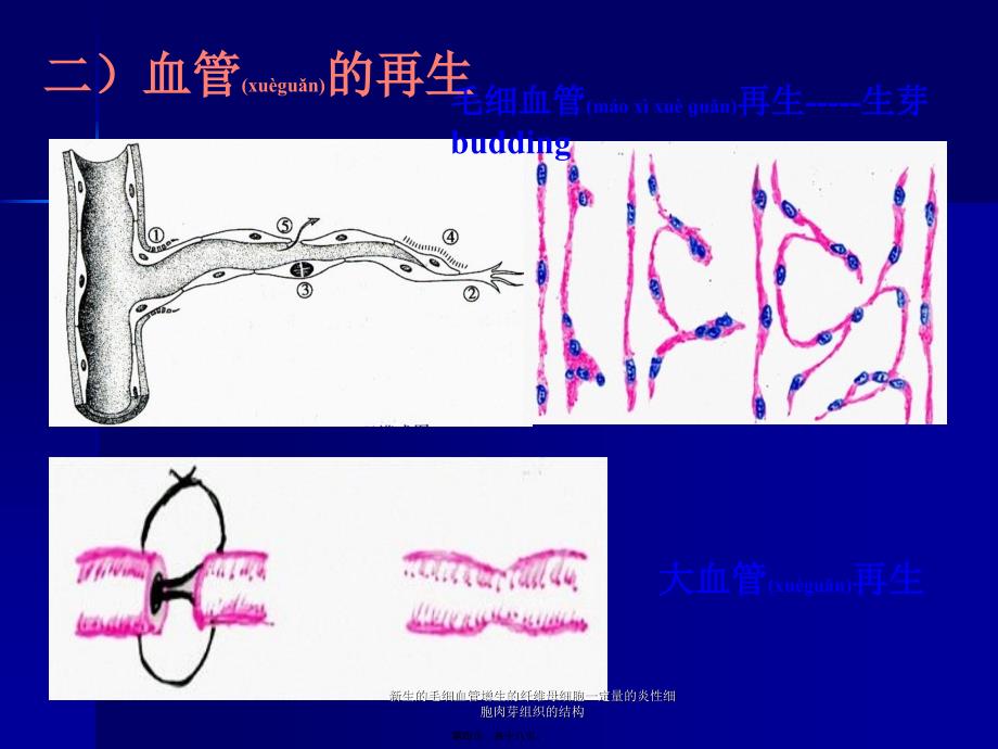 新生的毛细血管增生的纤维母细胞一定量的炎性细胞肉芽组织的结构课件_第4页