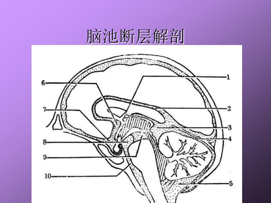 脑室脑池的断层解剖_第4页