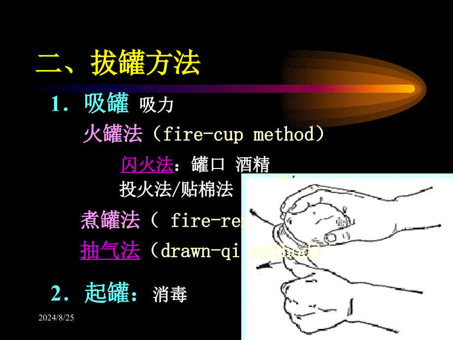 拔罐法课件PPT课件_第3页