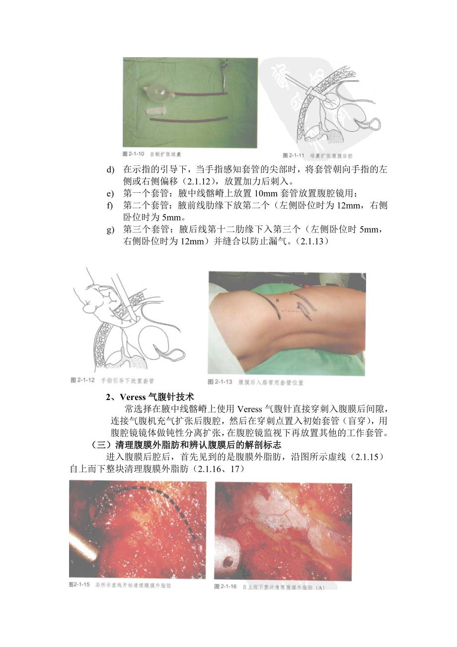 腹腔镜基本操作.doc_第4页