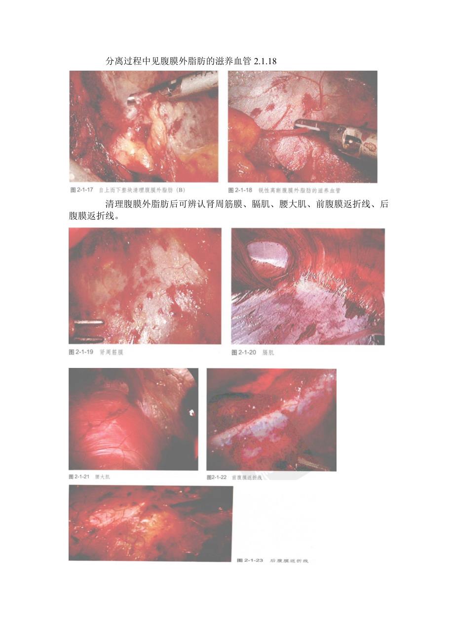 腹腔镜基本操作.doc_第5页