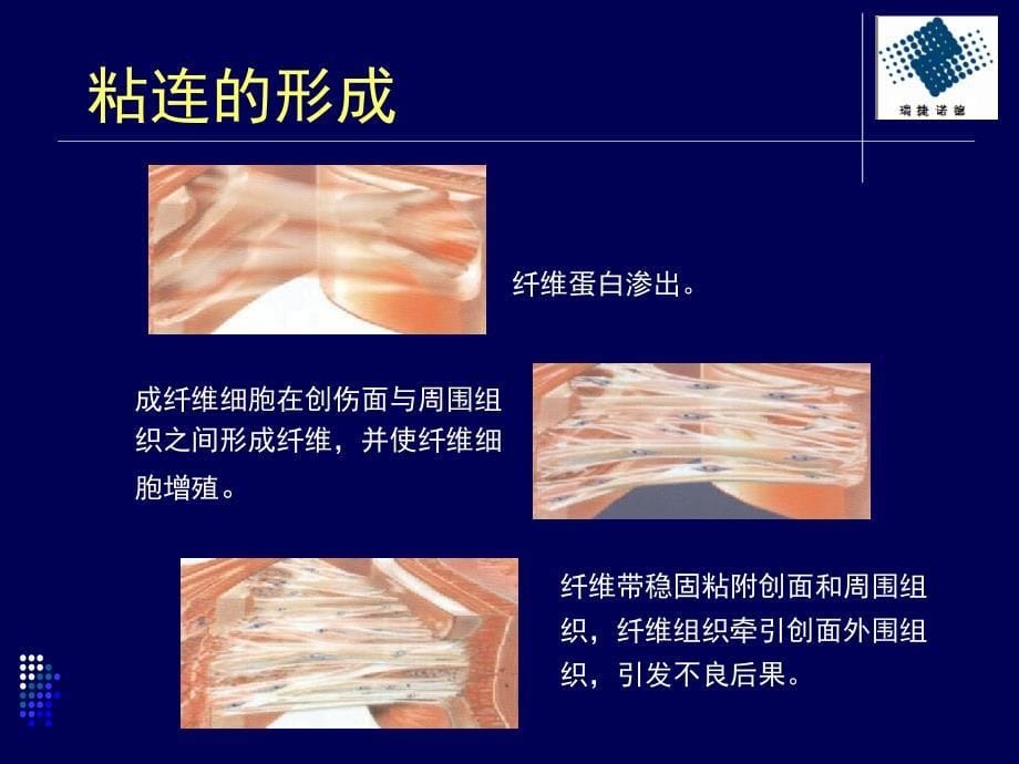 粘克,可吸收的防粘连膜_第5页