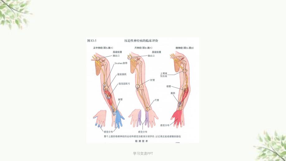 腕管综合征最新课件_第2页