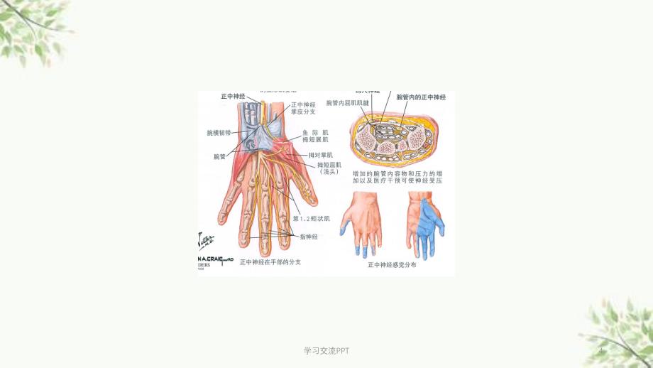 腕管综合征最新课件_第4页