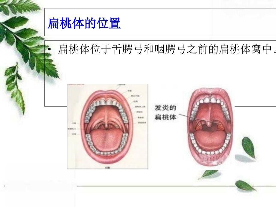 扁桃体摘除术体位的业务学习课件_第5页