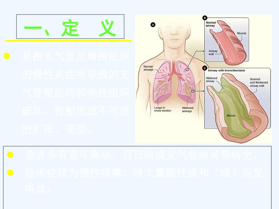 支气管扩张本科内科学课件_第4页