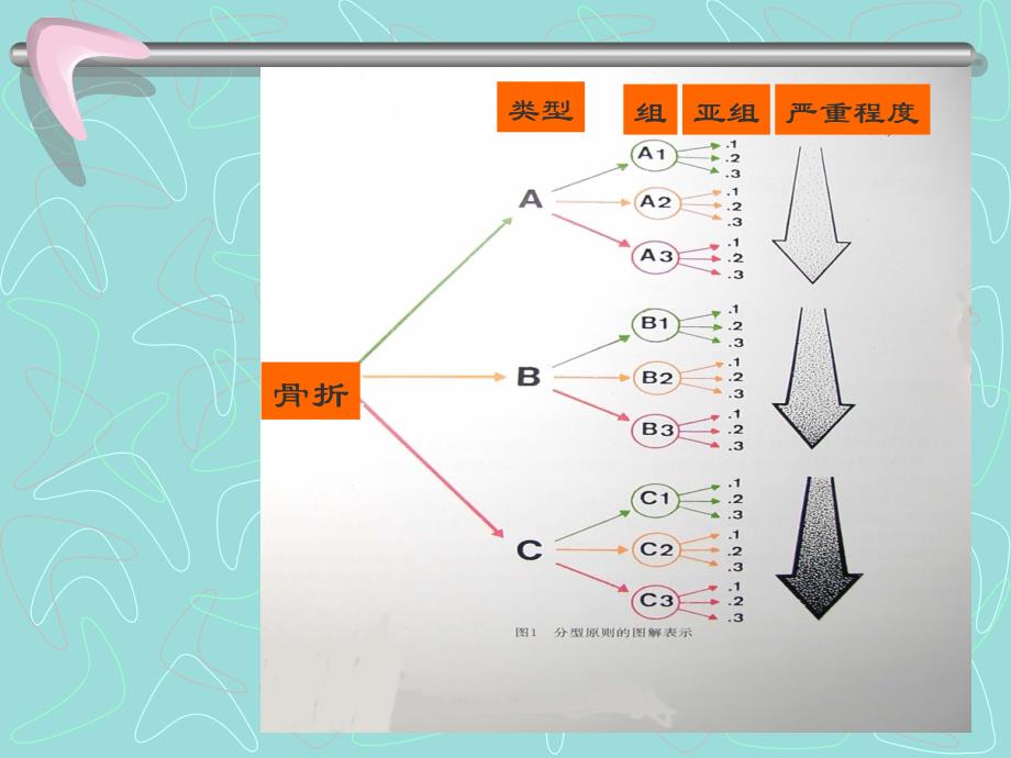 四肢长管状骨的-AO-综合分类_第3页