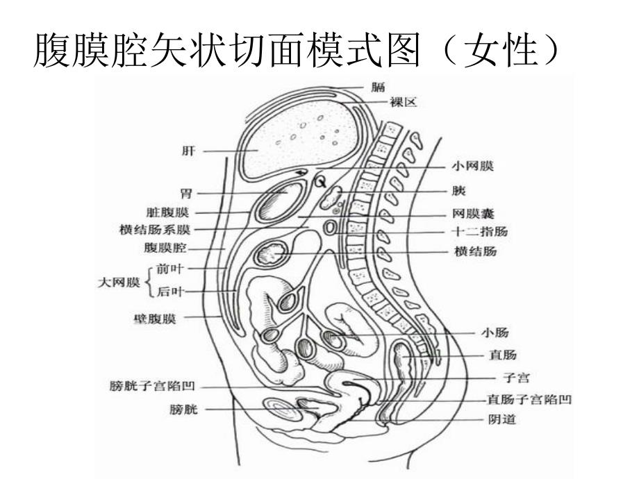 急性腹膜炎_第3页