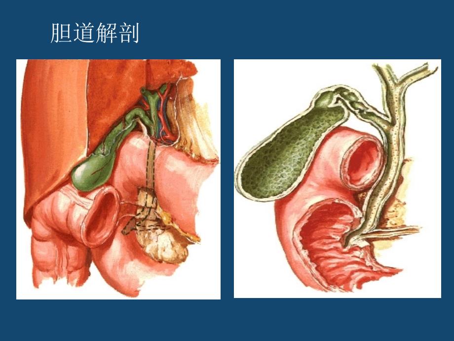 内科学-急性胆囊炎.ppt_第4页