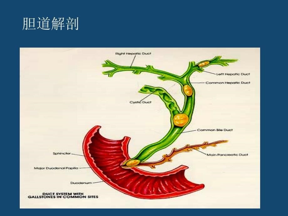 内科学-急性胆囊炎.ppt_第5页