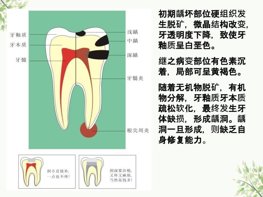 口腔卫生与美容保健_第5页