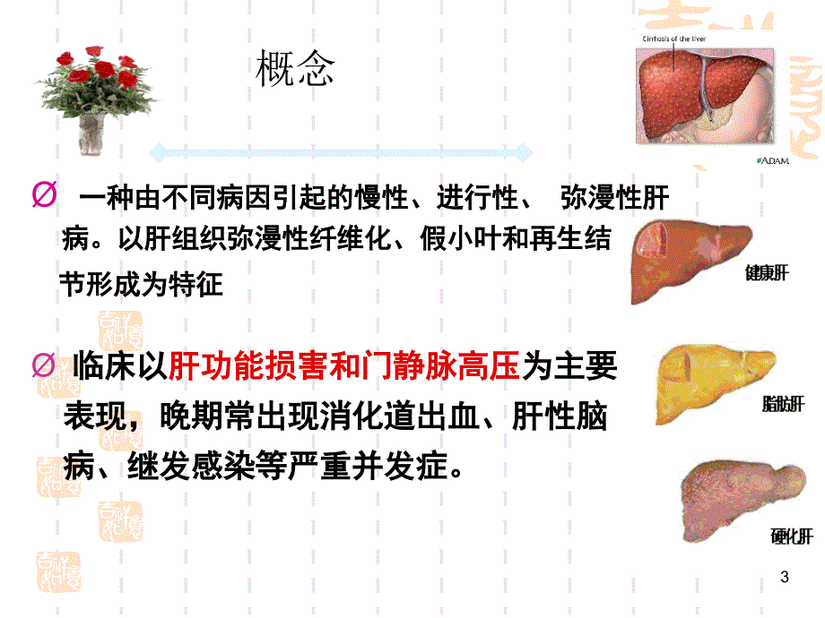 肝硬化病人的护理查房介绍ppt课件_第3页