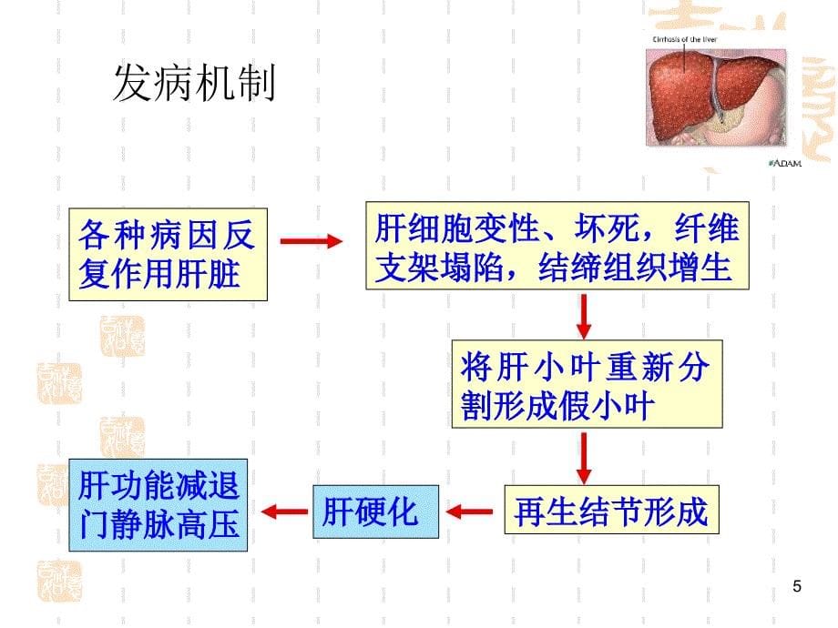 肝硬化病人的护理查房介绍ppt课件_第5页