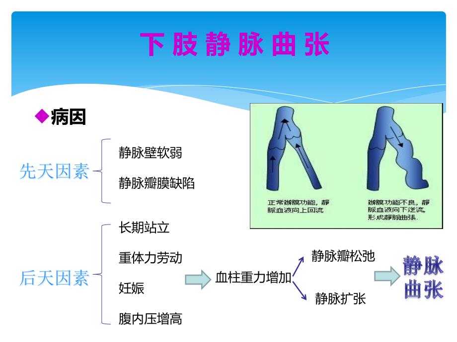 下肢静脉曲张护理查房PPT_第4页