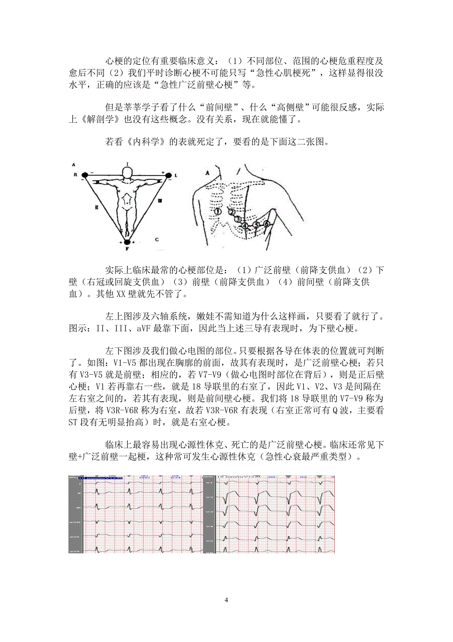 心电图简解 2(精品)_第4页